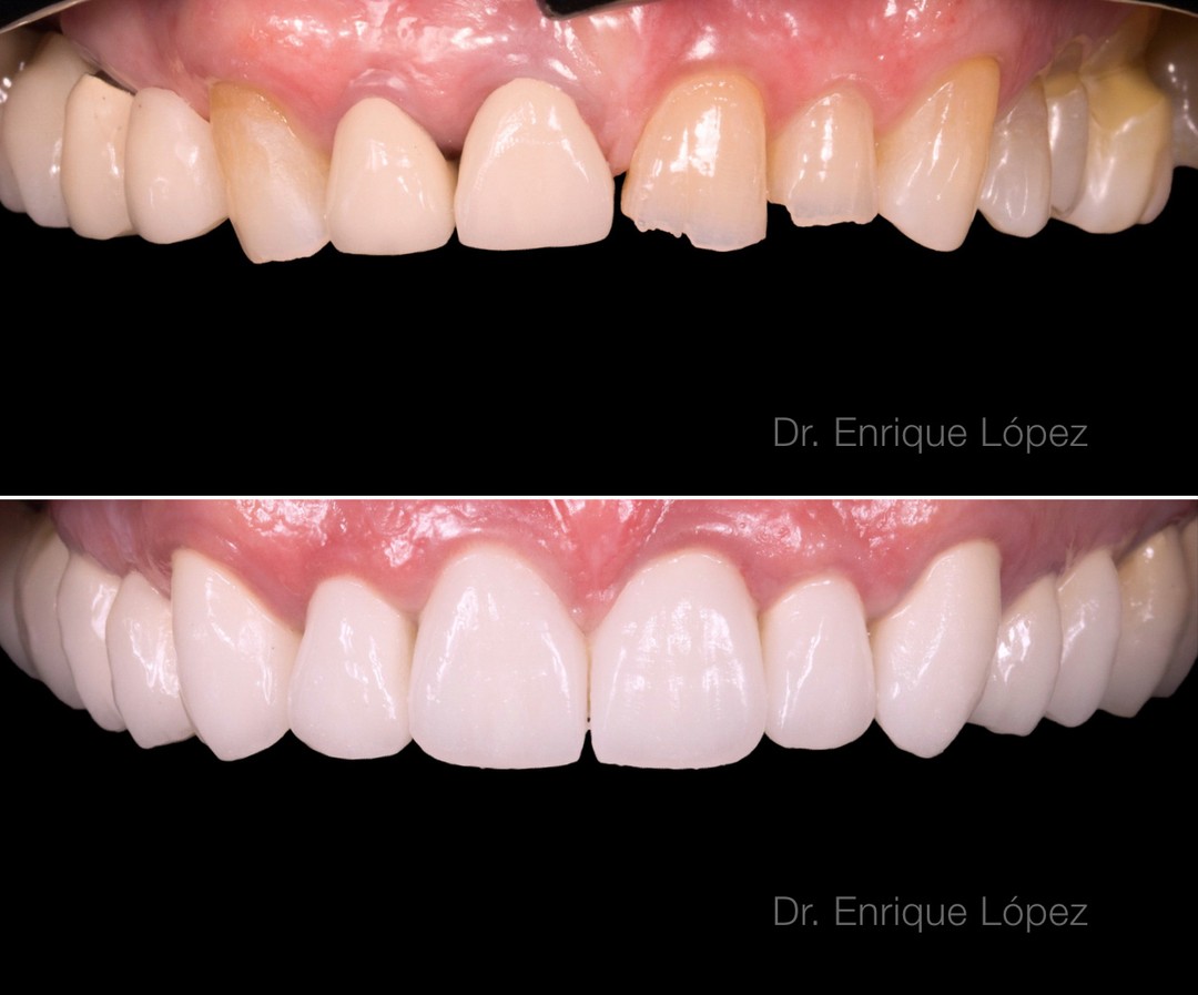 Foto comparativa 1