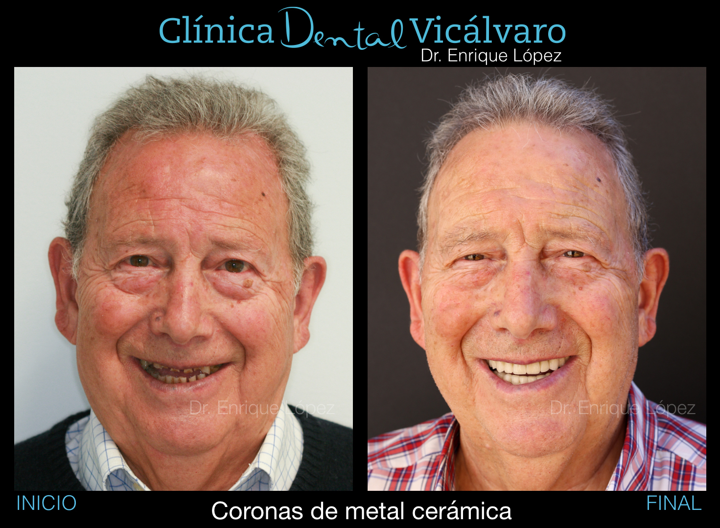 Foto comparativa 1