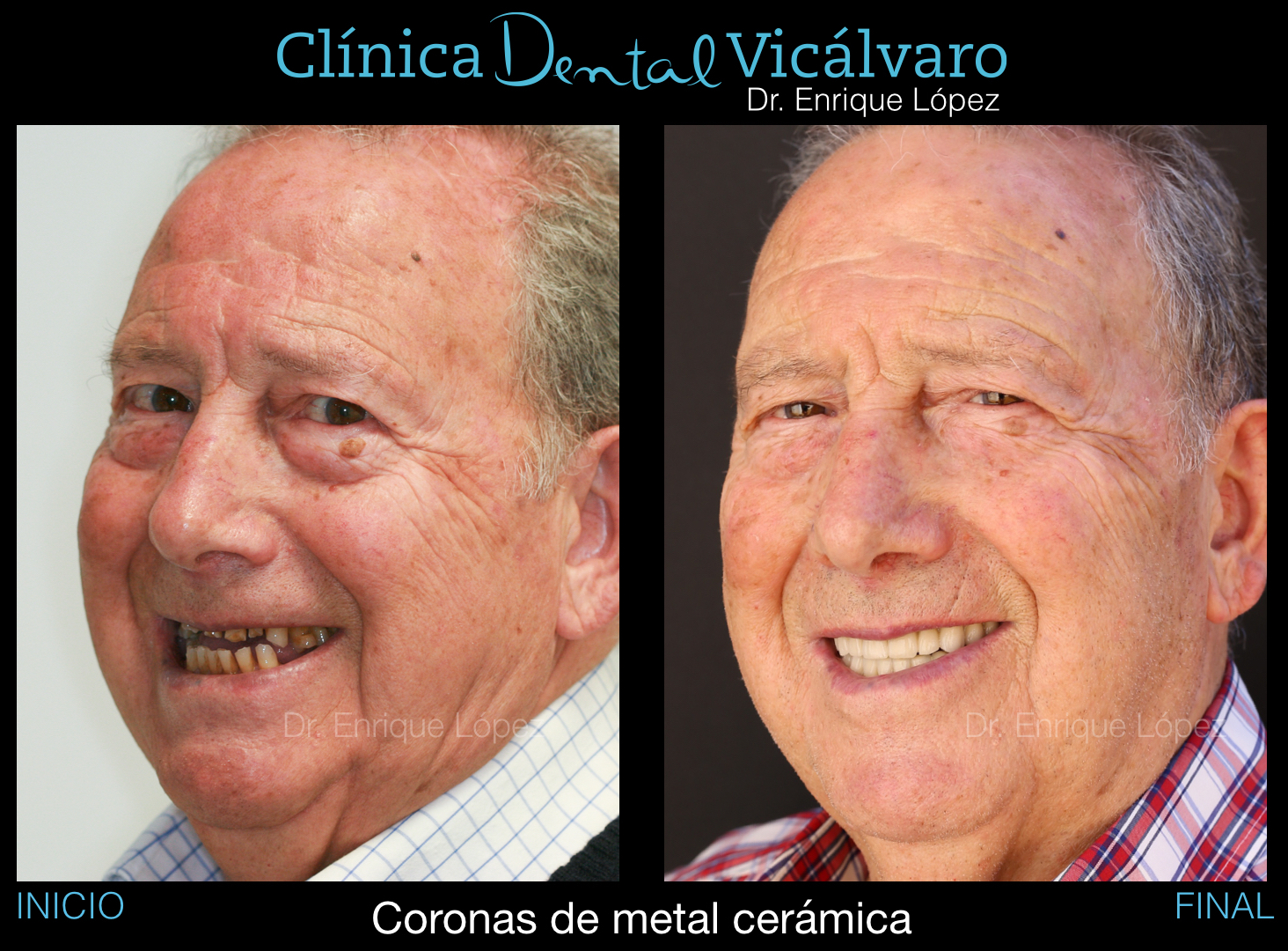 Foto comparativa 2