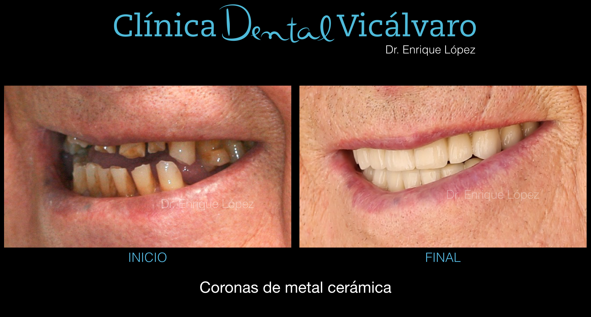 Foto comparativa 3