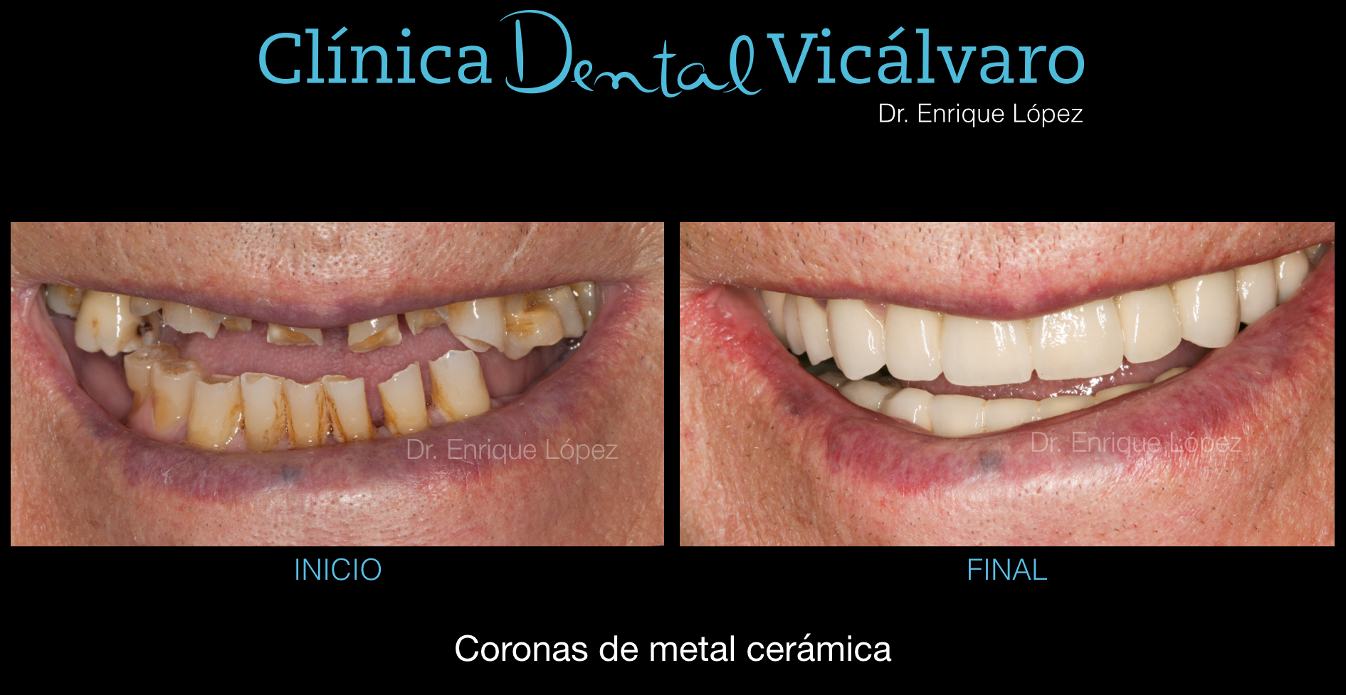 Foto comparativa 4