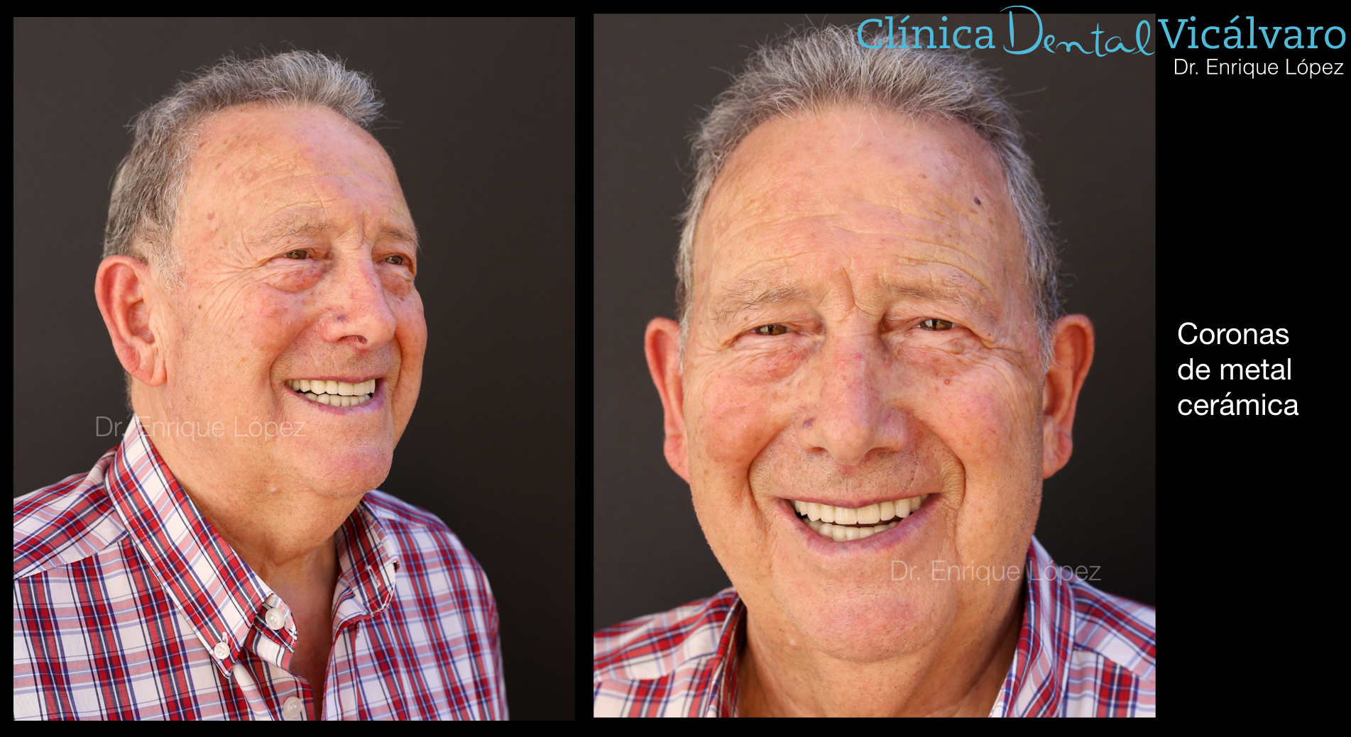 Foto comparativa 5
