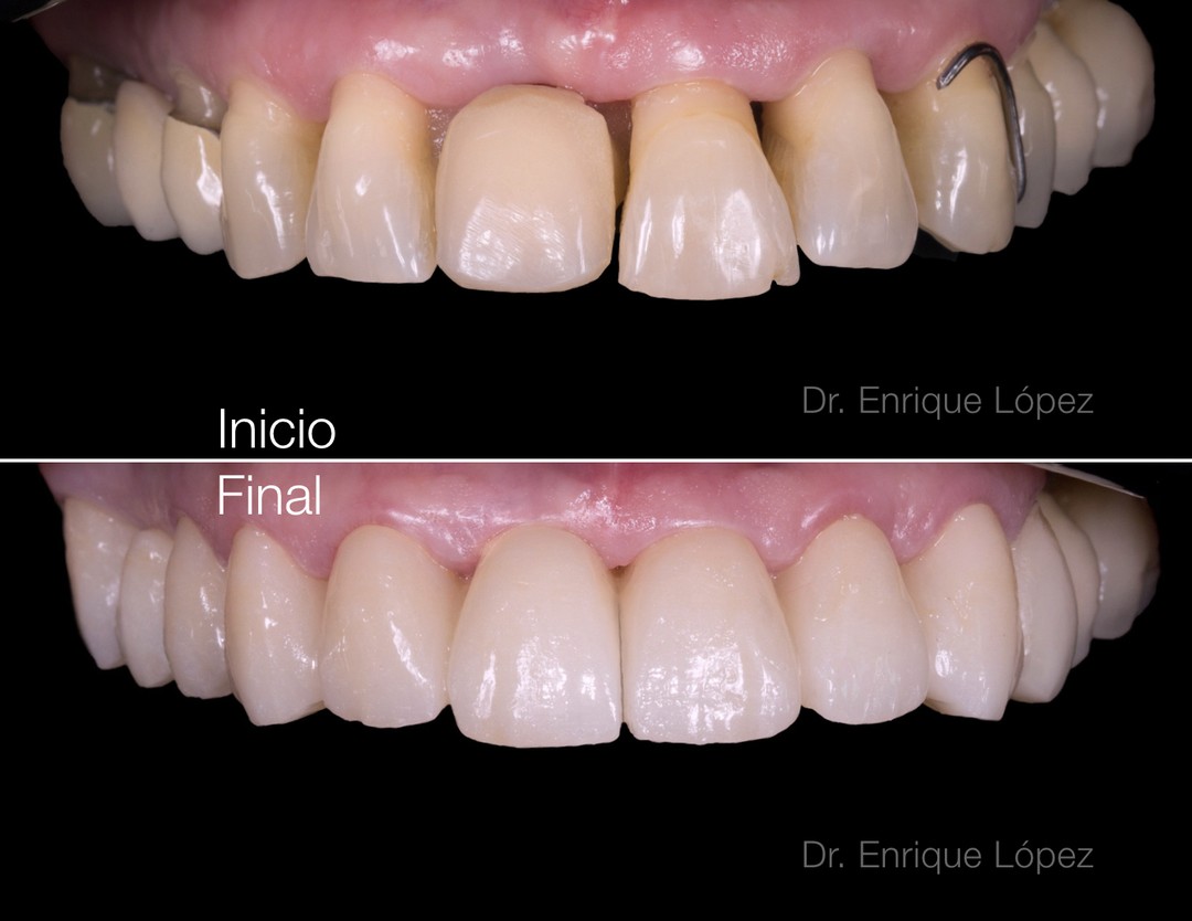 Foto comparativa 2
