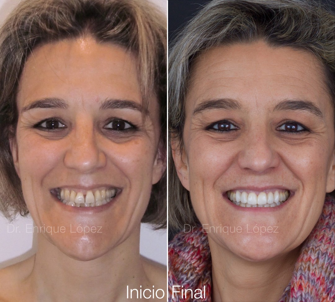 Foto comparativa 1