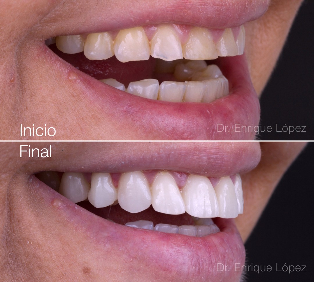 Foto comparativa 1