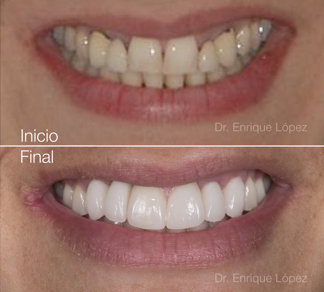Foto comparativa 2